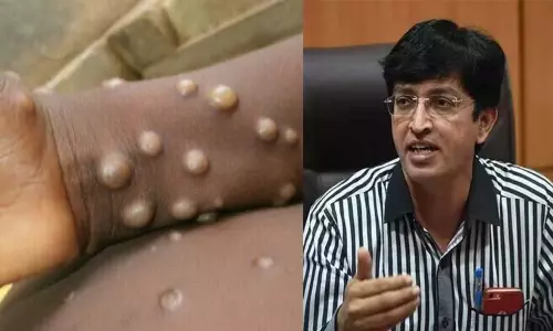 இந்தியாவில் குரங்கு காய்ச்சல் பாதிப்பு இல்லை; மக்கள் நல்வாழ்வுத்துறை செயலாளர் டாக்டர் ராதாகிருஷ்ணன் தகவல் இந்தியாவில் குரங்கு காய்ச்சல் பாதிப்பு இல்லை; மக்கள் நல்வாழ்வுத்துறை செயலாளர் டாக்டர் ராதாகிருஷ்ணன் தகவல்