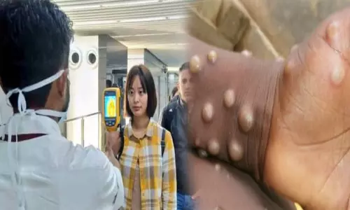 குரங்கம்மை பரவல் எதிரொலி: ஆப்பிரிக்கா, ஐரோப்பா நாடுகளில் இருந்து வரும் பயணிகள் கண்காணிப்பு