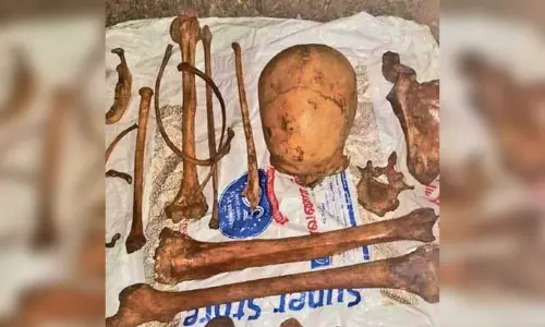 குப்பை தொட்டியில் மனித எலும்பு கூடு கிடந்ததால் பரபரப்பு - போலீசார் கைப்பற்றி விசாரணை குப்பை தொட்டியில் மனித எலும்பு கூடு கிடந்ததால் பரபரப்பு - போலீசார் கைப்பற்றி விசாரணை