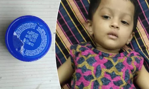 சிறுமியின் சுவாச குழாயில் சிக்கிய தைலம் டப்பா அறுவை சிகிச்சையின்றி அகற்றம் சிறுமியின் சுவாச குழாயில் சிக்கிய தைலம் டப்பா அறுவை சிகிச்சையின்றி அகற்றம்