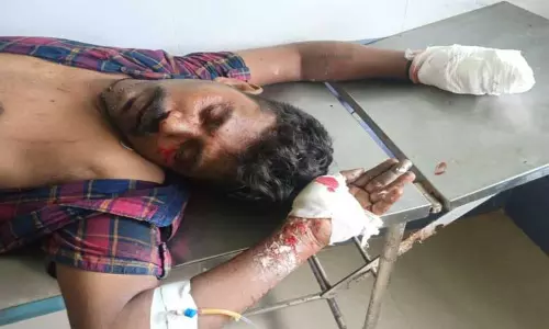 வனவிலங்குகளை வேட்டையாட வீட்டில் வெடிகுண்டு தயாரித்த வாலிபர் கைகள் சிதைந்தன