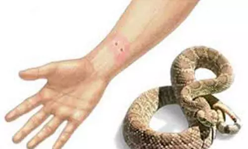 பாம்பு கடித்து பெண் பலி