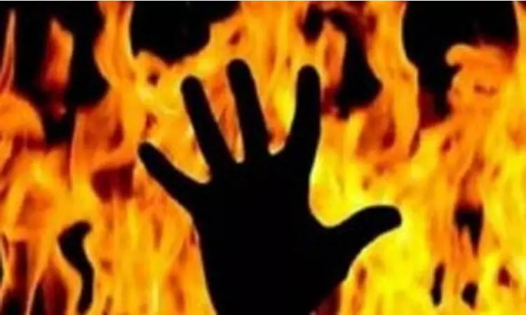 குடும்ப தகராறு - காதல் கணவரை பெட்ரோல் ஊற்றி தீ வைத்த மனைவி...!