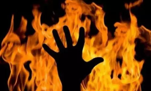 தீப்பிடித்து மூதாட்டி படுகாயம்