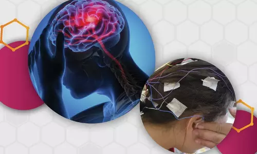 பெண்களை எளிதில் பாதிக்கும் பக்கவாதம்