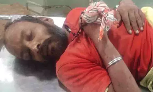 தலையில் வெட்டு காயங்களுடன் கிடந்த நபருக்கு தீவிர சிகிச்சை தலையில் வெட்டு காயங்களுடன் கிடந்த நபருக்கு தீவிர சிகிச்சை