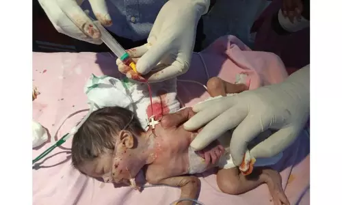 குறைபிரசவத்தில் பிறந்த குழந்தைக்கு இதயத்துக்கு செல்லும் ரத்த குழாயில் சிகிச்சை