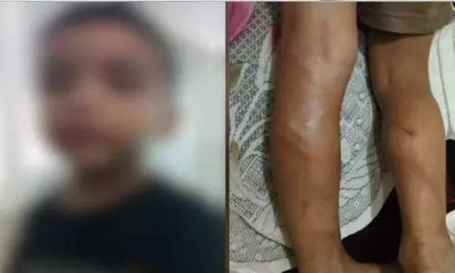 ஆங்கிலம் சரியாக படிக்கவில்லை; 4 வயது சிறுவன் மீது சரமாரி தாக்குதல் நடத்திய டியூசன் ஆசிரியர் ஆங்கிலம் சரியாக படிக்கவில்லை; 4 வயது சிறுவன் மீது சரமாரி தாக்குதல் நடத்திய டியூசன் ஆசிரியர்