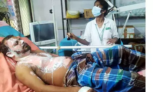 திருச்சி மத்திய சிறை சிறப்பு முகாமில் இலங்கை தமிழர் தீக்குளிப்பு