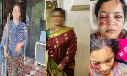 நடிகைக்கு மாமனார் பாலியல் தொல்லை...! கொலைவெறி தாக்குதல்?  காயங்களுடன் கண்ணீர் மல்க பேட்டி