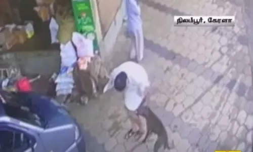 16 பேரை கடித்த தெரு நாய் உயிரிழப்பு... பிரேத பரிசோதனையில் காத்திருந்த அதிர்ச்சி !