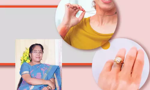 உலோகங்கள் ஏற்படுத்தும் ஒவ்வாமை