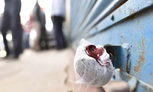 மாடு அறுவை மனைக்கு சீல்