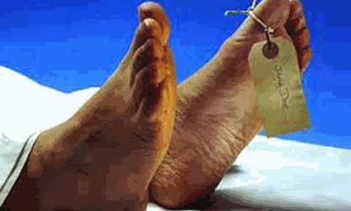திராவகம் குடித்த முதியவர் சாவு திராவகம் குடித்த முதியவர் சாவு