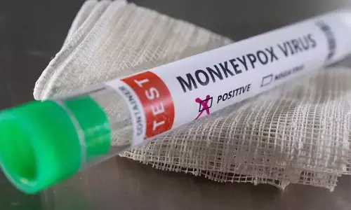 பெரியம்மை நோய்க்கான தடுப்பூசியை குரங்கு அம்மை நோய்க்கு பயன்படுத்த ஐரோப்பிய ஆணையம் ஒப்புதல் பெரியம்மை நோய்க்கான தடுப்பூசியை குரங்கு அம்மை நோய்க்கு பயன்படுத்த ஐரோப்பிய ஆணையம் ஒப்புதல்