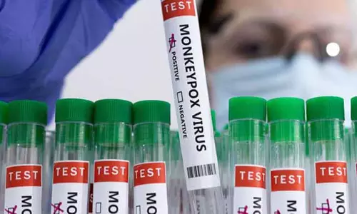 குரங்கு அம்மை வைரசை ஐ.சி.எம்.ஆர். பிரித்து எடுத்தது - தடுப்புமருந்து கண்டுபிடிக்க வழிபிறக்கும் என தகவல்