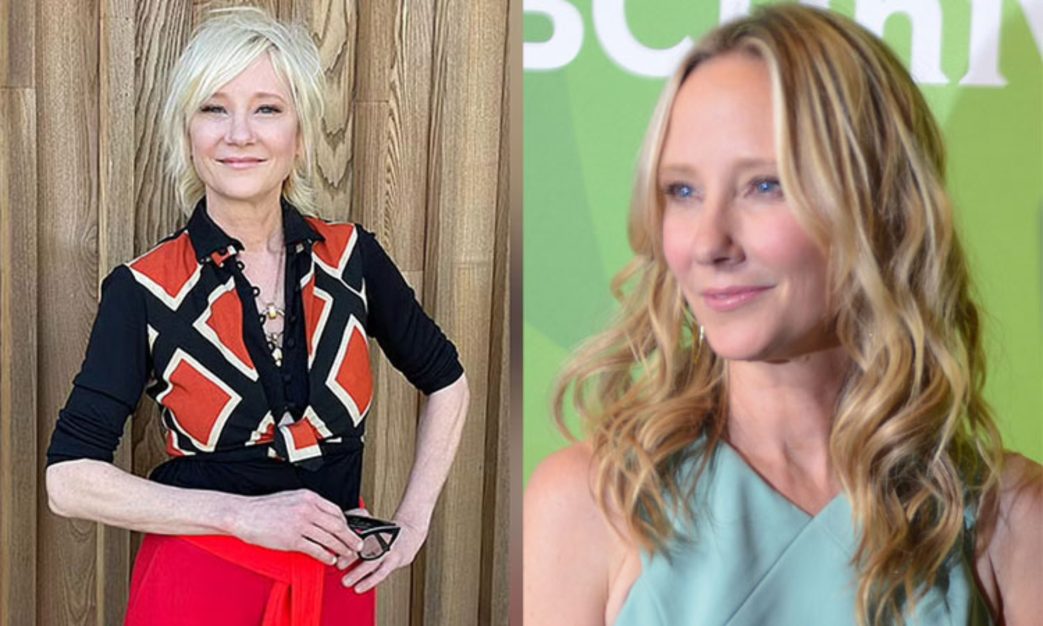 Actor Anne Heche Severely Burned After Car Crash Into Los Angeles Home |  America: The car in which the famous actress was traveling lost control and an accident - the car caught fire ...