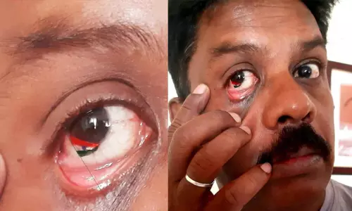 தேசியக் கொடியை கண் இமைப்போல பாதுகாக்க வேண்டும் - கண் விழிக்குள் தேசியக்கொடி வரைந்த நகை தொழிலாளி தேசியக் கொடியை கண் இமைப்போல பாதுகாக்க வேண்டும் - கண் விழிக்குள் தேசியக்கொடி வரைந்த நகை தொழிலாளி