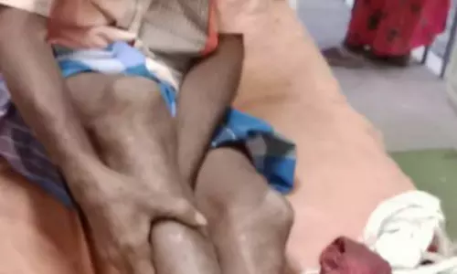 கரடி தாக்கி தொழிலாளி காயம்