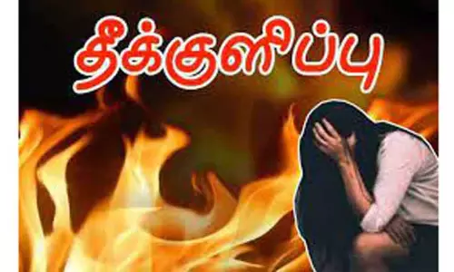 குடும்ப தகராறில் பெண் தீக்குளிப்பு காப்பாற்ற முயன்ற கணனும் காயம் குடும்ப தகராறில் பெண் தீக்குளிப்பு காப்பாற்ற முயன்ற கணனும் காயம்