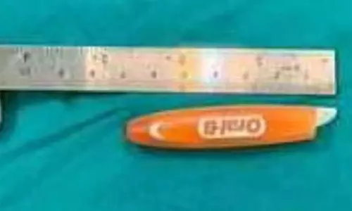 பெண்ணின் கண்ணில் குத்திய டூத்பிரஸ் அகற்றம்