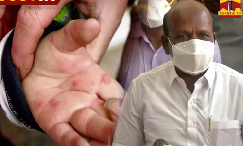 தக்காளி காய்ச்சலை கட்டுப்படுத்த கேரள எல்லைகளில் கண்காணிப்பு தீவிரம் - அமைச்சர் மா.சுப்பிரமணியன்