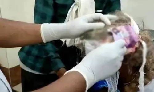 அலட்சியத்தின் உச்சம்: பெண்ணிற்கு தலையில் ஆணுறையை வைத்து கட்டுப்போட்ட சுகாதார மைய ஊழியர்