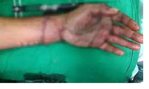 புல்தானா அருகே அரசு பஸ் உரசி சென்றதில் 2 பேரின் கைகள் துண்டாகின புல்தானா அருகே அரசு பஸ் உரசி சென்றதில் 2 பேரின் கைகள் துண்டாகின