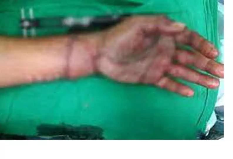 புல்தானா அருகே அரசு பஸ் உரசி சென்றதில் 2 பேரின் கைகள் துண்டாகின புல்தானா அருகே அரசு பஸ் உரசி சென்றதில் 2 பேரின் கைகள் துண்டாகின