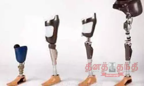 நவீன செயற்கை கால், கை வழங்குவதற்கான சிறப்பு முகாம்