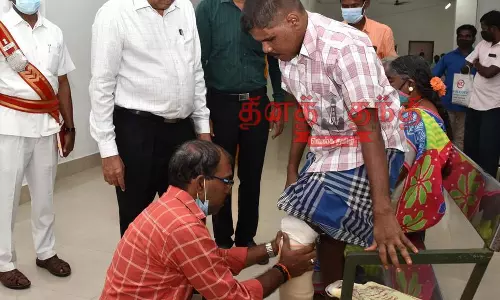 மாற்றுத்திறனாளிக்கு செயற்கை கால்