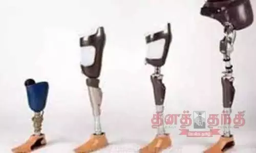 நவீன செயற்கை கால், கை வழங்குவதற்கான அளவீடு செய்யும் முகாம்