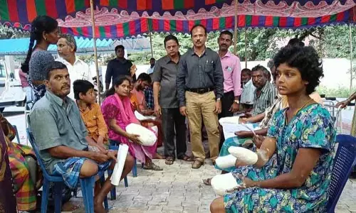 மாற்றுத்திறனாளிகளுக்கு செயற்கை கை, கால் அளவீடு செய்யும் முகாம்