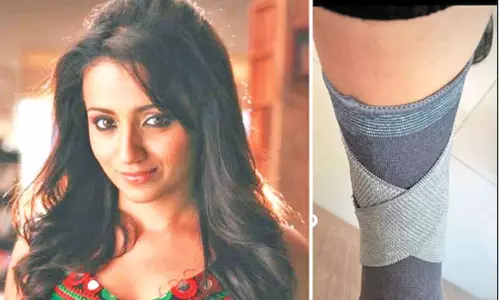 திரிஷாவுக்கு காலில் காயம்