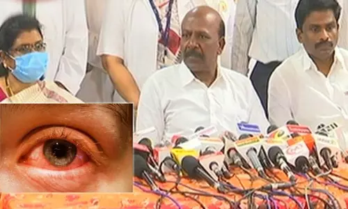 டிசம்பர் 2-வது வாரத்திற்கு பின் மெட்ராஸ் ஐ இருக்காது - அமைச்சர் மா.சுப்பிரமணியன் பேட்டி டிசம்பர் 2-வது வாரத்திற்கு பின் மெட்ராஸ் ஐ இருக்காது - அமைச்சர் மா.சுப்பிரமணியன் பேட்டி