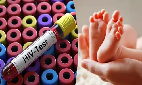 பிறந்த குழந்தைகளுக்கான எய்ட்ஸ் பரிசோதனை கருவிகளுக்கு தட்டுப்பாடு..? பிறந்த குழந்தைகளுக்கான எய்ட்ஸ் பரிசோதனை கருவிகளுக்கு தட்டுப்பாடு..?