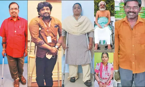 மாற்றுத்திறனாளிகளை மதிப்போம்