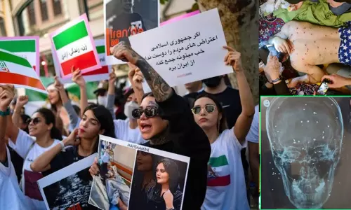 ஈரான்: ஹிஜாப் எதிர்ப்பு போராட்டத்தில் பெண்களின் கண்கள், மார்பு, பிறப்புறுப்பை குறிவைத்து துப்பாக்கிச்சூடு - பகீர் தகவல்