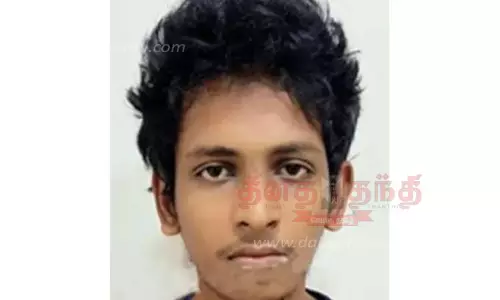 பயங்கரவாதி ஷாரிக்கிற்கு இன்று பிளாஸ்டிக் அறுவை சிகிச்சை