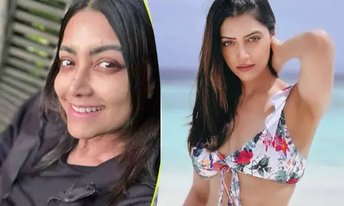 என் நிறம் மாறுகிறது...! தீவிர நோயால் பாதிப்பு நடிகை உருக்கமான பதிவு...!