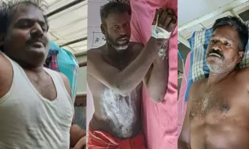 மின்சாரம் பாய்ந்து 3 தொழிலாளர்கள் படுகாயம் மின்சாரம் பாய்ந்து 3 தொழிலாளர்கள் படுகாயம்