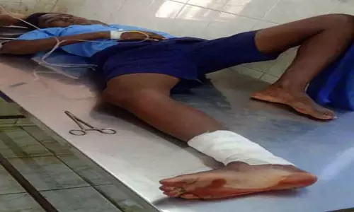 பள்ளி மாணவனை கடித்துக்குதறிய குரங்கு