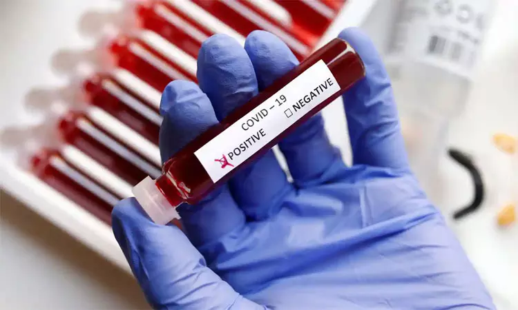 இந்தியாவில் மேலும் 95 பேருக்கு தொற்று இந்தியாவில் மேலும் 95 பேருக்கு தொற்று