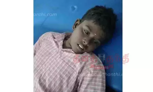 அரசு பள்ளியில் மாணவரை பாம்பு கடித்தது