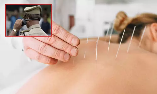 அக்குபங்சர் சிகிச்சை... 50 பெண்களை நிர்வாண வீடியோ எடுத்த மருத்துவர்; அதிர்ந்த போலீசார்