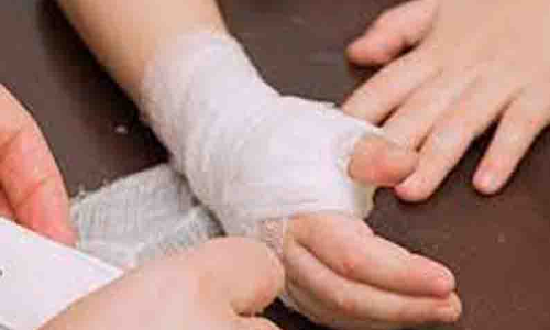 சமையல் செய்யும்போது தீப்பிடித்து பெண் காயம்