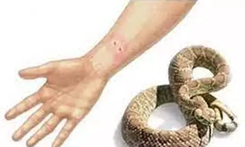 பாம்பு கடித்து பெண் பலி பாம்பு கடித்து பெண் பலி