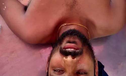 மின்கம்பியில் இருந்து தீப்பொறி விழுந்து 15 பேர் காயம் மின்கம்பியில் இருந்து தீப்பொறி விழுந்து 15 பேர் காயம்