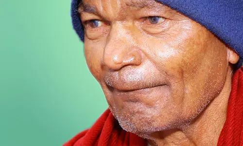 கோவை அரசு ஆஸ்பத்திரிக்கு முதியவரின் உடல் தானம்