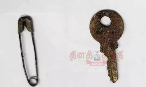 சாவி, ஊக்குகளை விழுங்கிய குழந்தைகள்  - ஆபரேஷன் இன்றி அகற்றி அரசு டாக்டர்கள் சாதனை